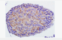 半胱胺酸蛋白酶蛋白3Caspase-3