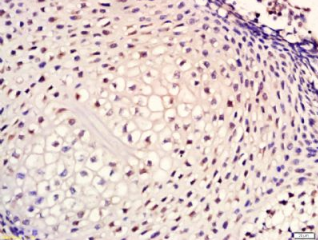 Bax抗体文献引用