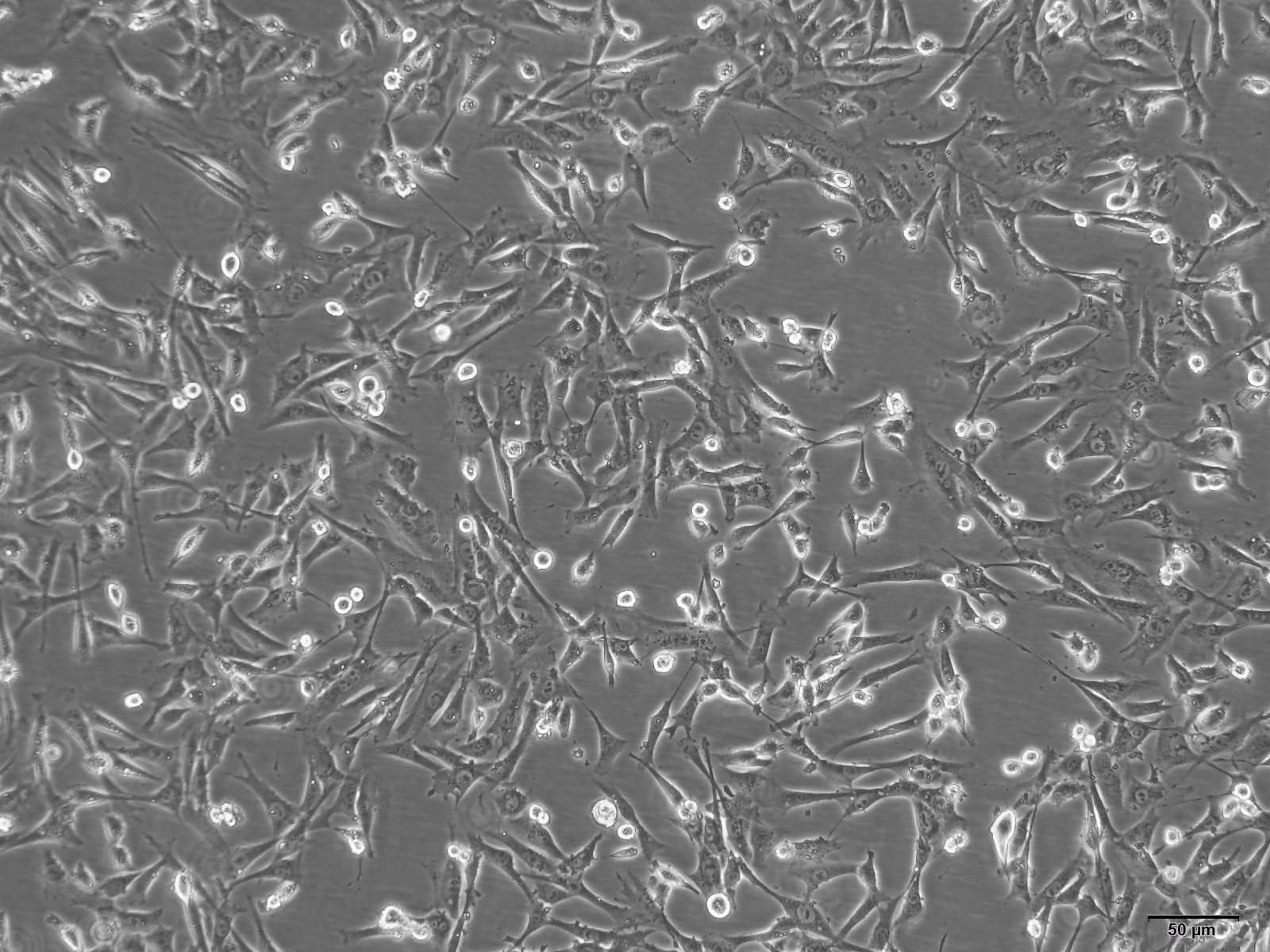 大鼠骨髓来源内皮祖细胞完全培养基