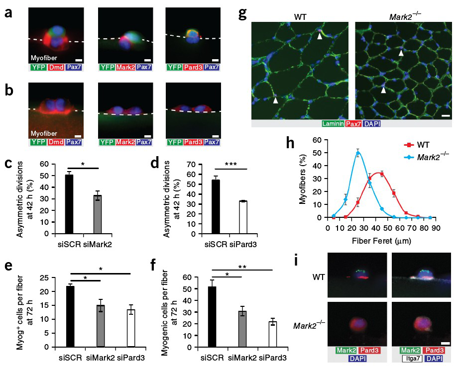Dystrophin 在肌肉干细胞中的表达及调节作用