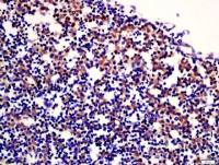 phospho-c-kit(Tyr936) antibody