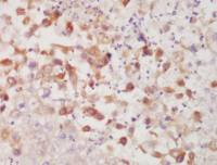 Cytokeratin 7 antibody