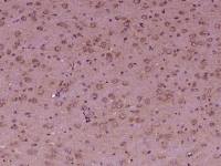OSBPL6 antibody