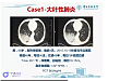 基层医生到呼吸感染科进修后，如何开展工作？