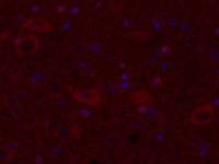 Dopamine D3 receptor antibody