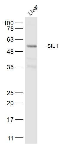 SIL1 antibody
