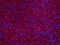 人急性T淋巴细胞白血病细胞/人淋巴细胞瘤细胞