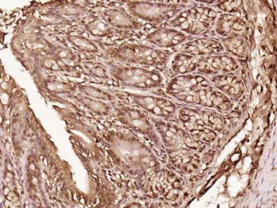 LTV1/C6orf93 antibody