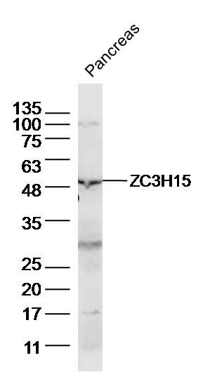 ZC3H15 antibody