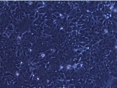 人结直肠腺癌上皮细胞HCT-15