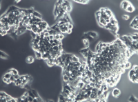 HepG2人肝癌细胞