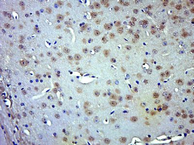 phospho-Smad3 (Thr179) antibody