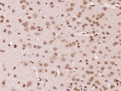 Nance-Horan Syndrome Protein antibody