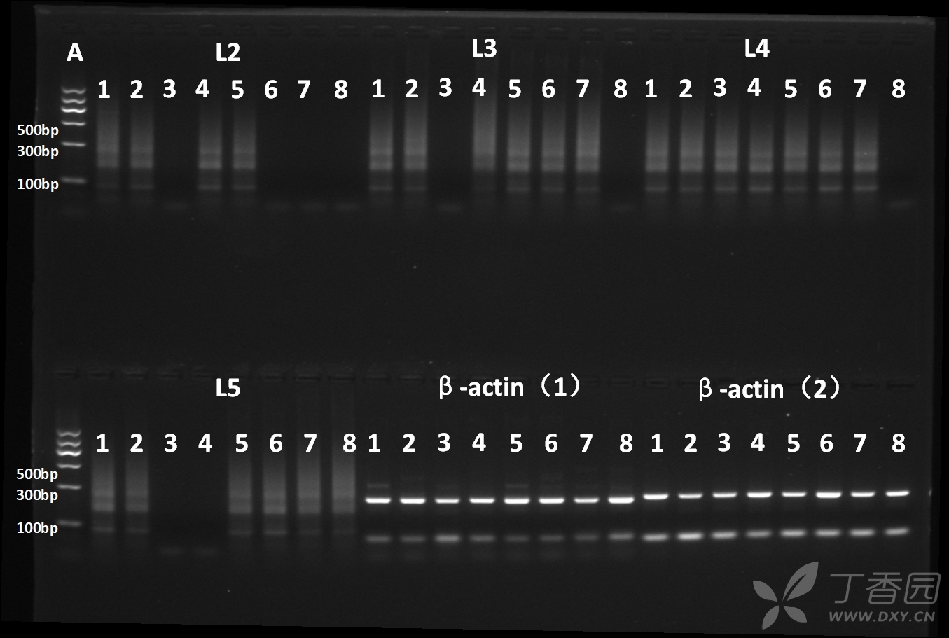 单细胞rt-pcr:二次pcr产生严重smear条带,求助怎么解决?