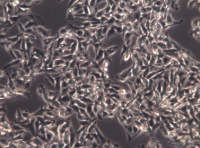 HuTu-80人十二脂肠腺癌