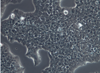 BT-474 [BT474]人乳腺导管癌细胞