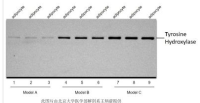 Tyrosine Hydroxylase酪氨酸羟化酶抗体