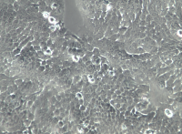 SCL-1人皮肤磷癌细胞