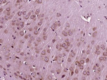 IGF 1胰岛素样生长因子1抗体