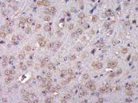 PABP2 antibody