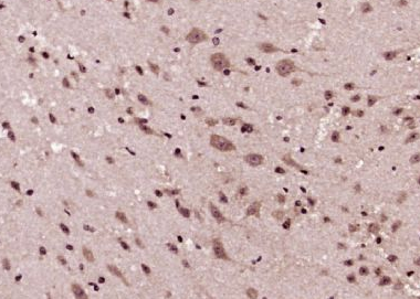 GSK-3 Beta糖原合酶激酶-3β抗体