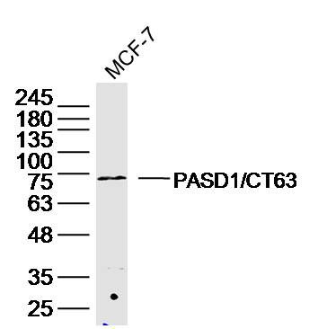 PASD1/CT63 antibody