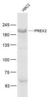 PREX2 antibody