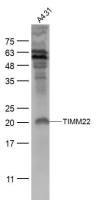TIMM22 antibody