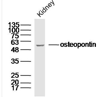 osteopontin骨桥蛋白/分泌型磷蛋白1抗体