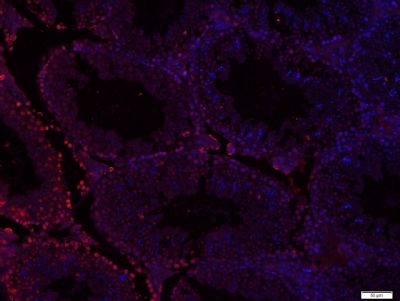 phospho-Src (Ser75) antibody