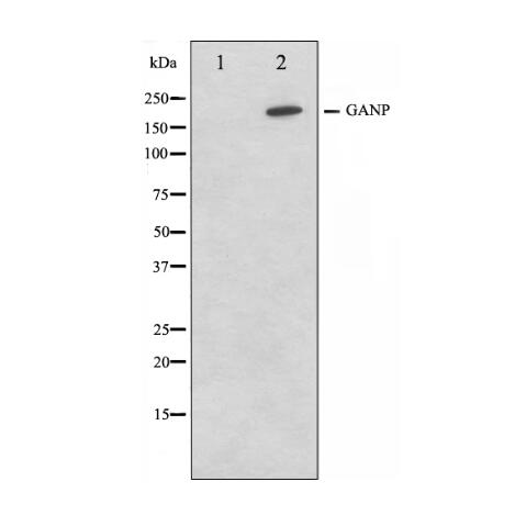 EEF1D Antibody 多克隆抗体产品图