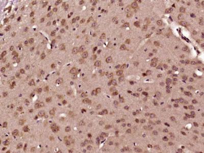 PCBP2 antibody