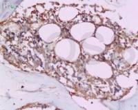 OPG骨保护蛋白/护骨素抗体