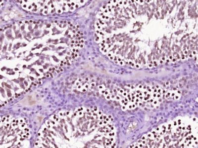 HSP70热休克蛋白70抗体