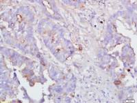 IFN gamma干扰素-γ/IFN-γ抗体