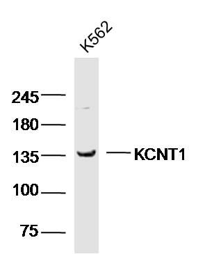 KCNT1 antibody