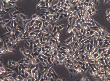 人急性早幼粒白血病细胞STR鉴定