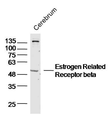 Estrogen Related Receptor beta antibody