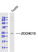 ZCCHC13 antibody