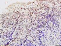 Livin凋亡抑制蛋白抗体