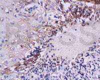 IL-6白介素6抗体