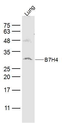 B7H4 antibody