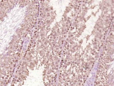 Anillin antibody