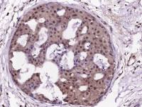 CDKN2A/p16-INK4a antibody