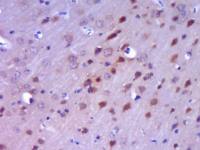 Androgen receptor antibody