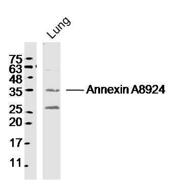 Annexin A8 antibody