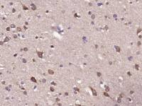 Dopamine D2 Receptor antibody
