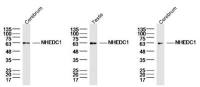 NHEDC1 antibody