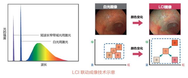 全国无症状早期胃癌筛查项目 GICC 无锡地区内