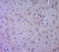 DCX/Doublecortin antibody